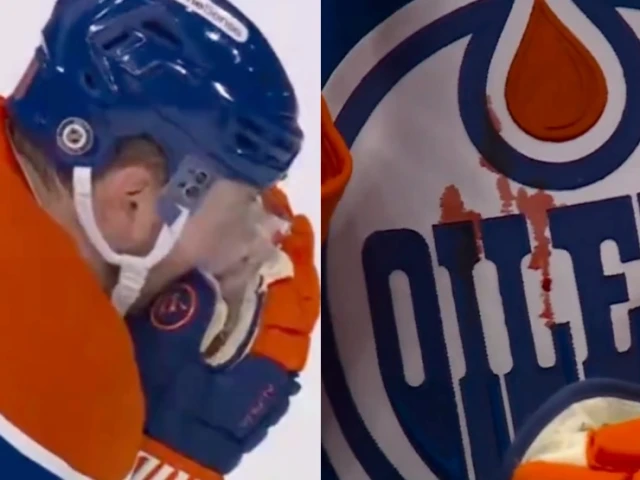 Hyman sported bloody Oilers jersey after nasty puck to the face