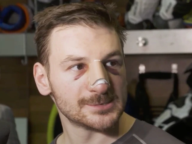 Edmonton Oilers’ Hyman has disgusting description of broken nose