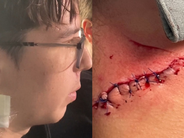 Edmonton junior hockey player kicked in neck by skate